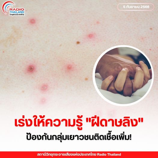 รูปภาพหน้าปก 2c3bb903-52d1-4571-b27b-548dc7d6fed9