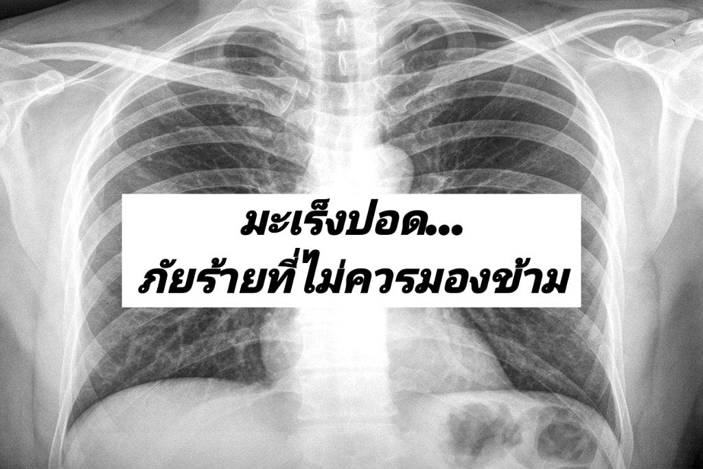 รูปภาพหน้าปก 9d57bb79-fbd3-471c-a691-df9f33a462cc