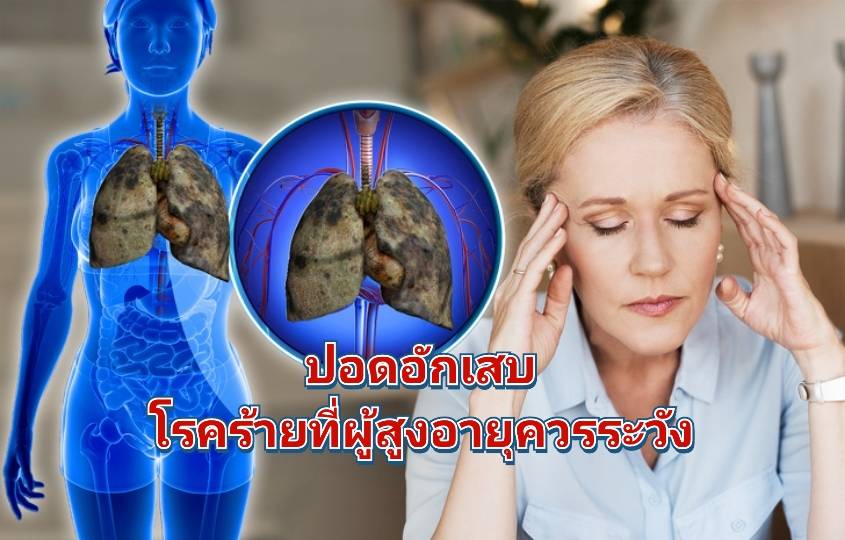 รูปภาพหน้าปก 53dcaaf1-7a34-4b7b-b85d-10e2abb91484