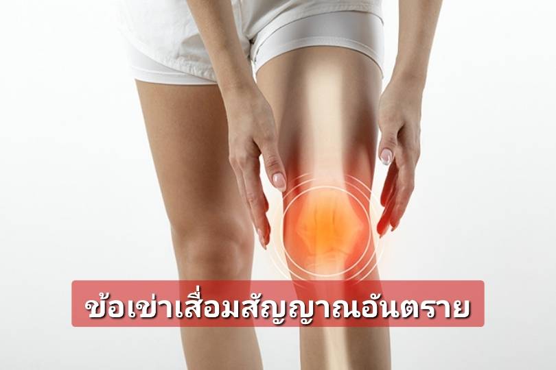 รูปภาพหน้าปก 1dbea73b-4792-4e1a-9213-20cfc9bca60c
