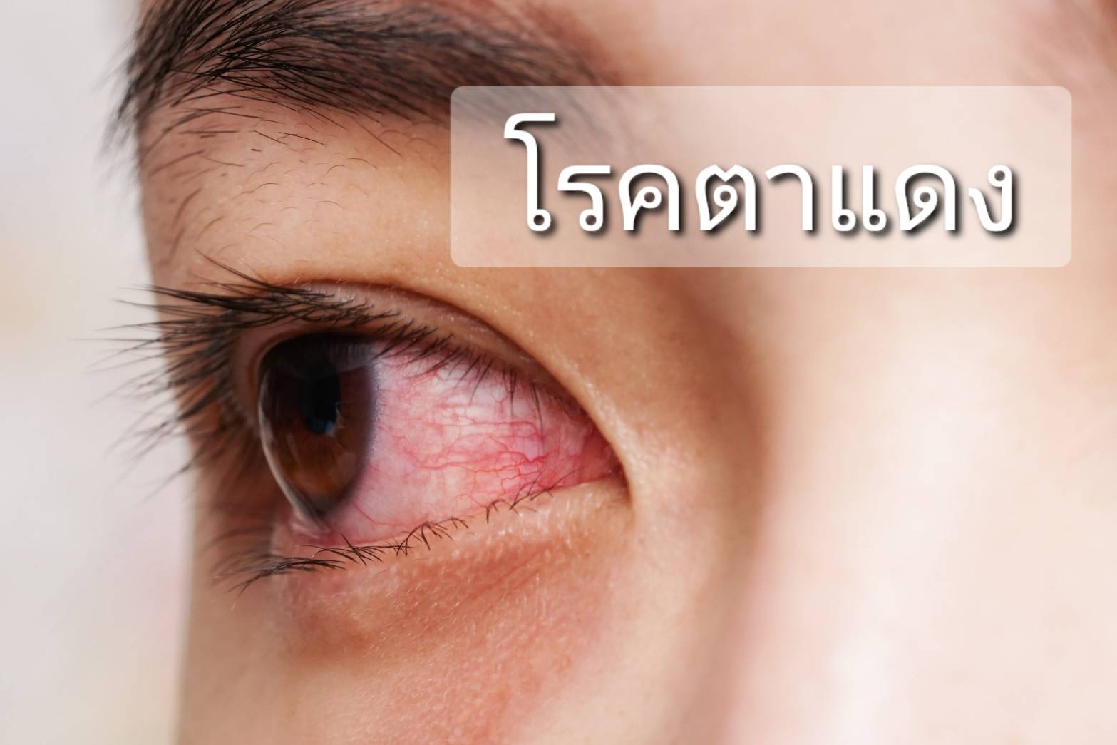 รูปภาพหน้าปก f3f279f9-a5a9-4e92-a065-d3cd999f113b