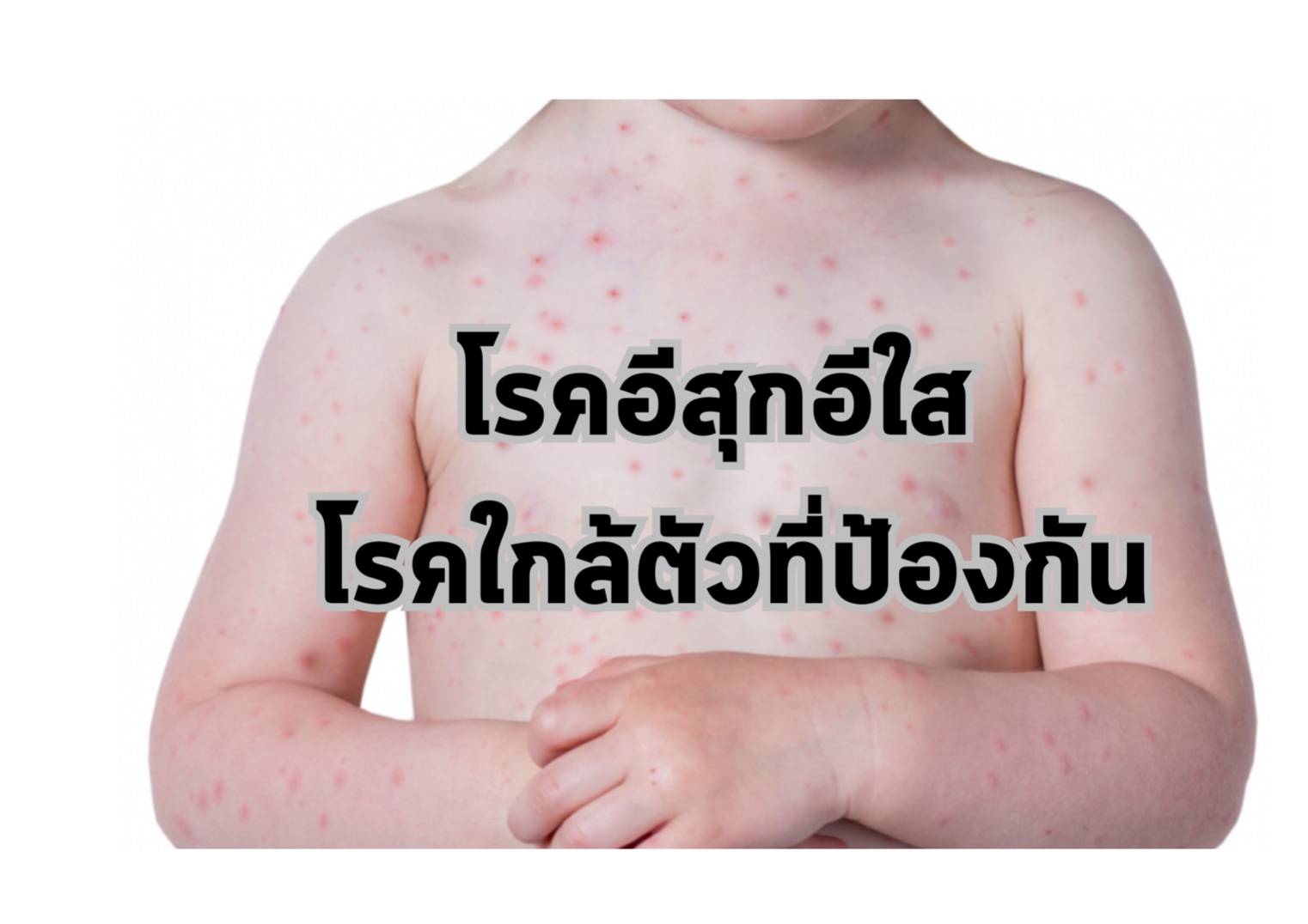 รูปภาพหน้าปก 3d35a696-aaaa-461c-b46a-6c617176d75b