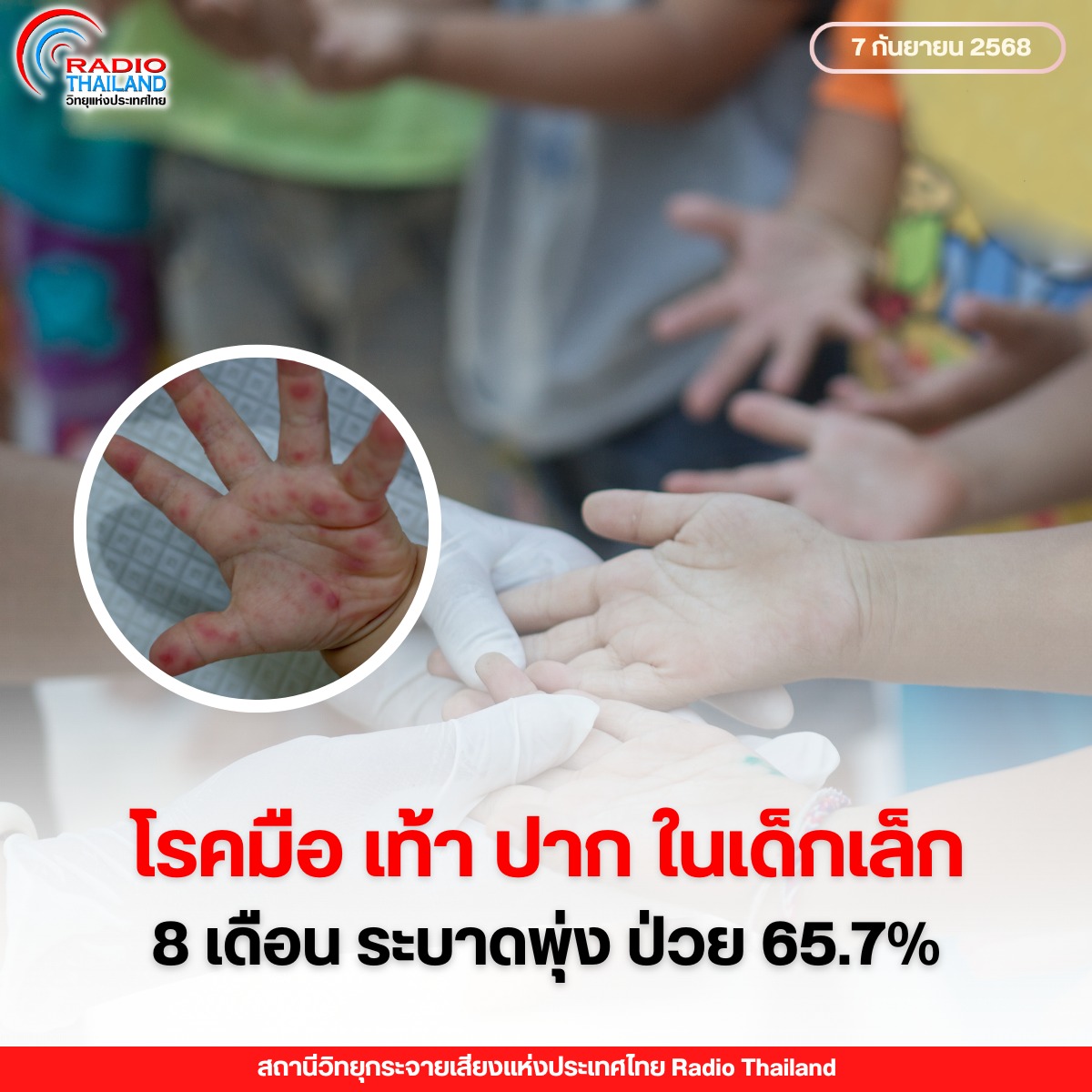 รูปภาพหน้าปก e00d4f1a-242f-400f-b34c-01a558d52920