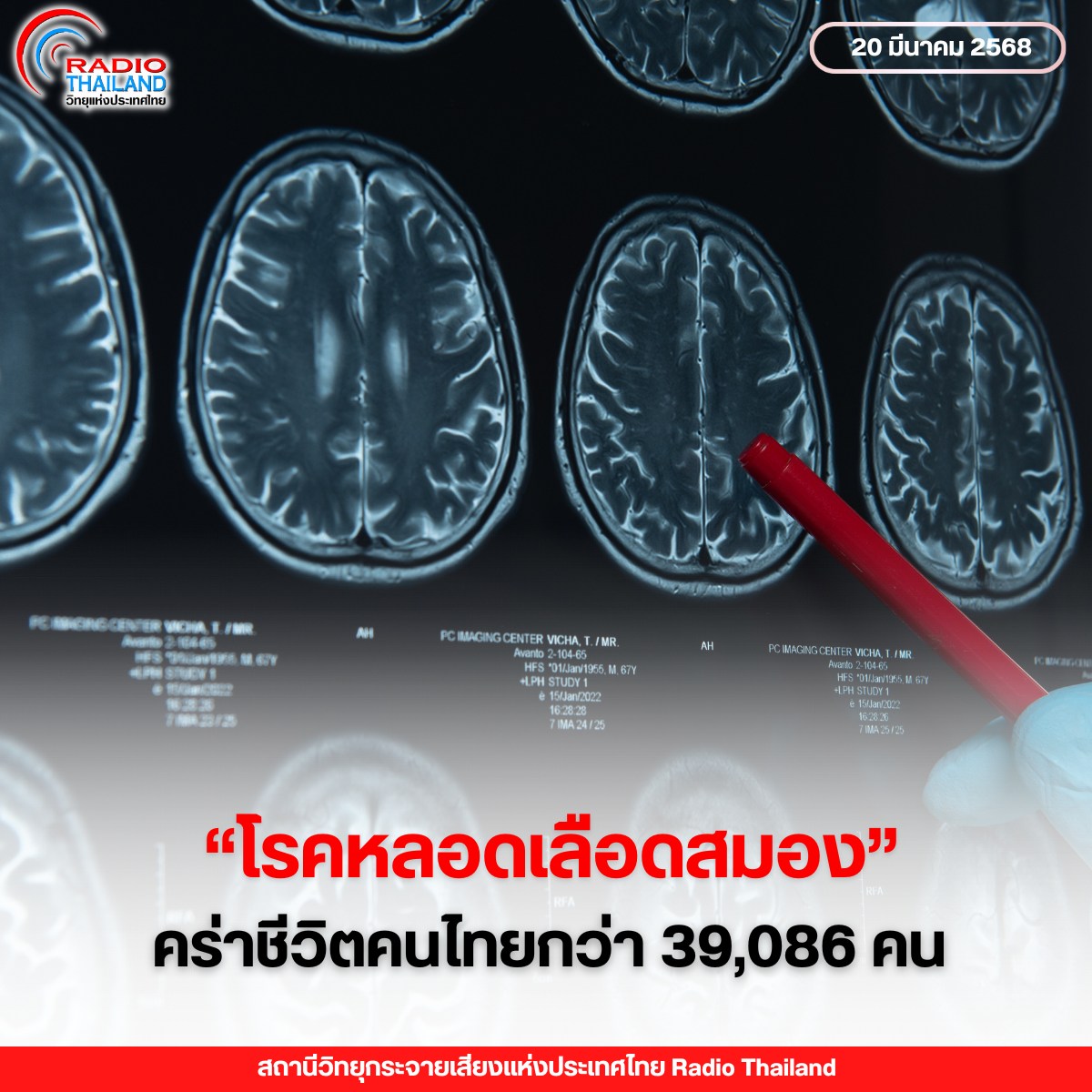 รูปภาพหน้าปก 1c35e438-fb12-4d89-91cc-1dd1e0e69d4a