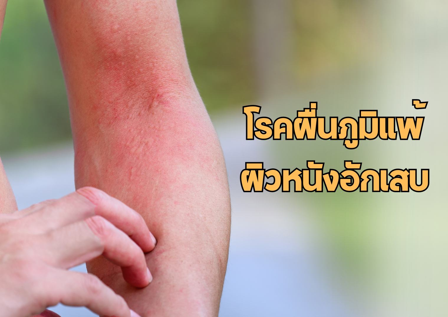 รูปภาพหน้าปก e3c67ba0-f92d-4e52-a5df-7ce8d89ce194