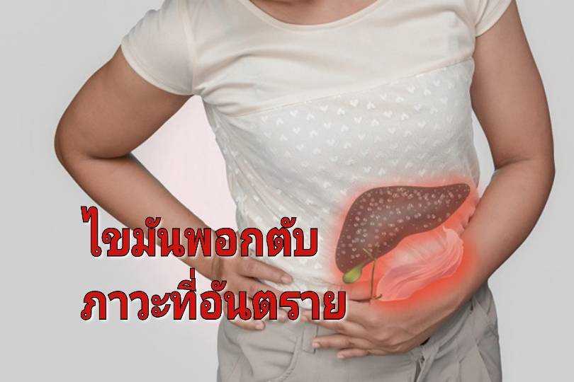 รูปภาพหน้าปก 5cf611c9-2dd4-467c-ac8e-0b36a33309bb