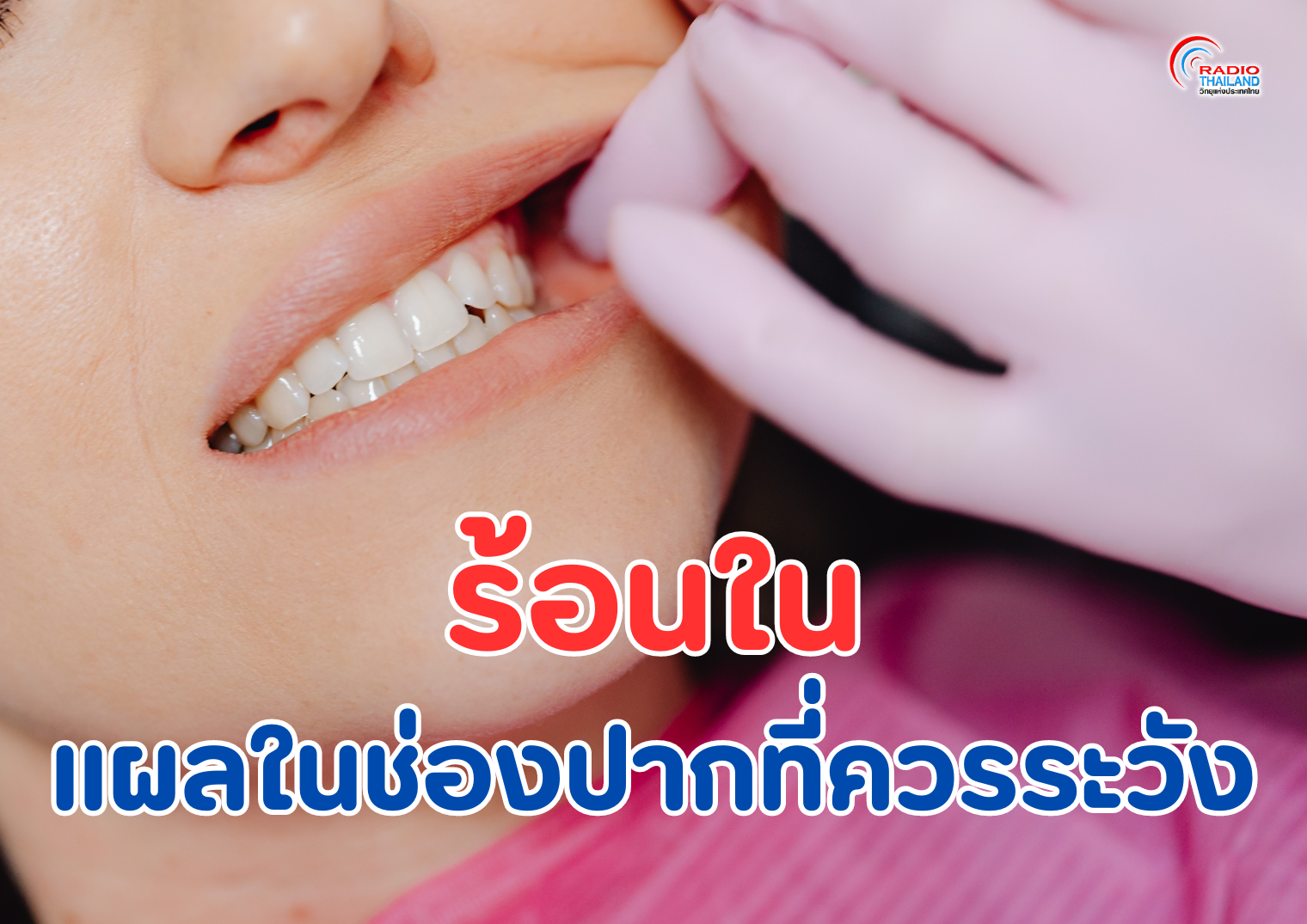 รูปภาพหน้าปก 928126ce-3816-4441-8a5f-c9a108f9df9c