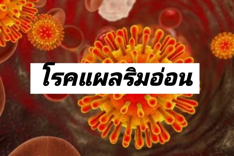 รูปภาพหน้าปก 2a9f99e7-c5fb-4233-8b09-38f30a109178