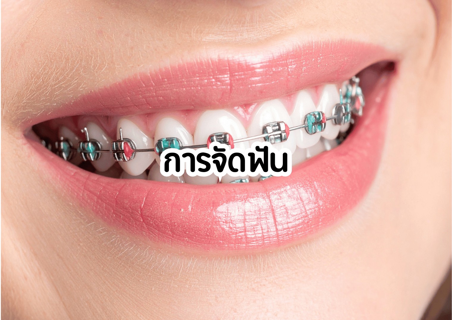 รูปภาพหน้าปก 410179c6-508b-4b7f-bd94-268d73e348c3