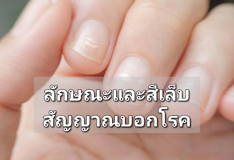 รูปภาพหน้าปก 10b873f9-cefb-4015-bf4b-8414b5c38aaa