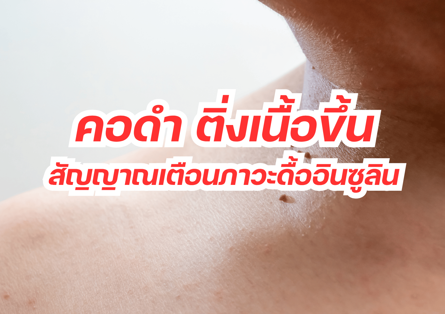รูปภาพหน้าปก 649765e6-9c96-4920-98bf-3a6203ad81ee