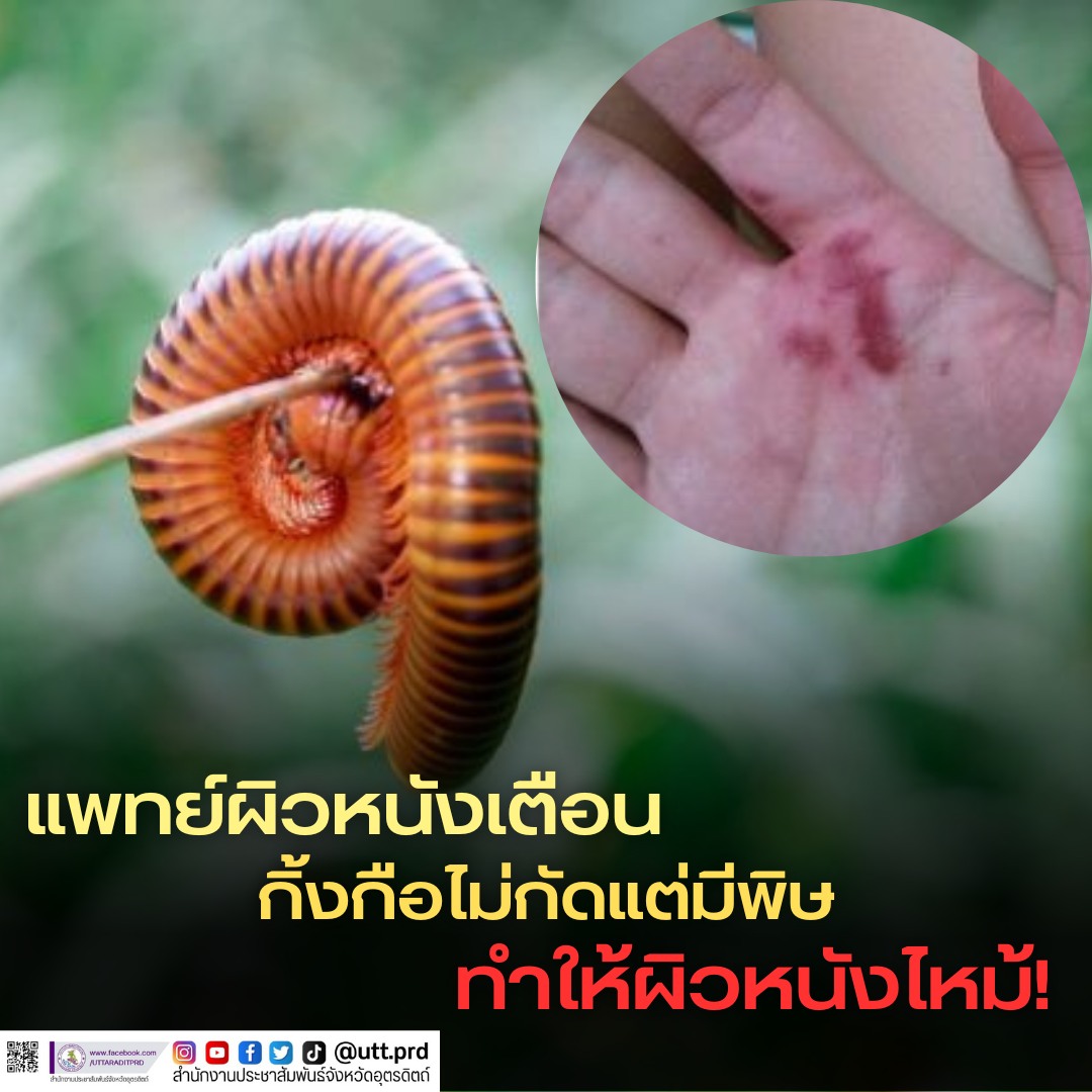 รูปภาพหน้าปก e090001d-6221-423d-8cfb-75fb9d30345a