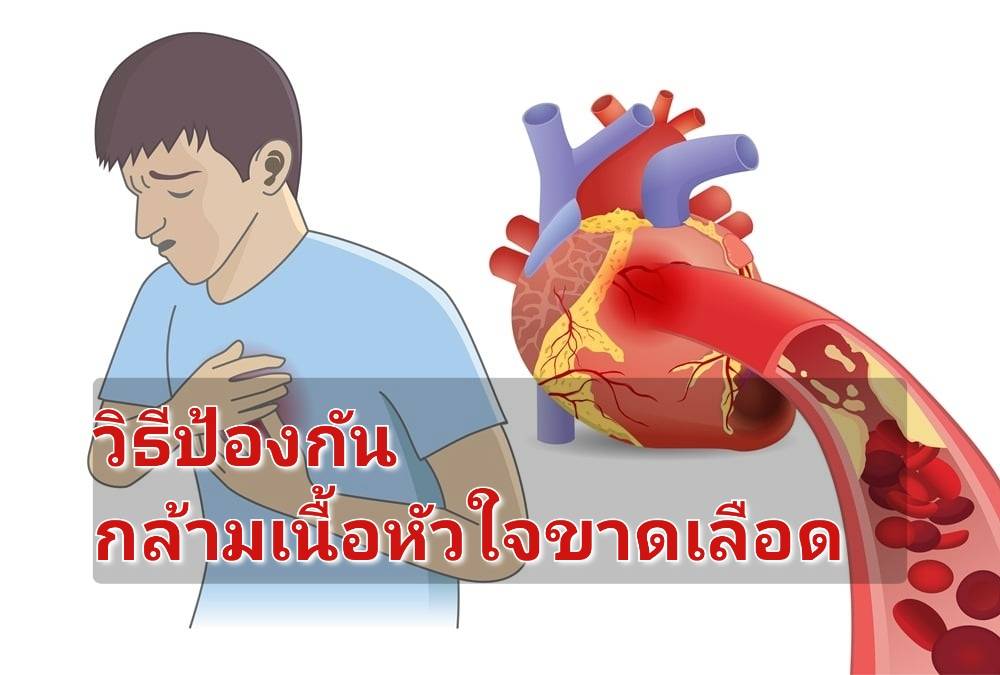 รูปภาพหน้าปก 7d7dde20-d1d3-4e64-94d0-5ce6d418fae8