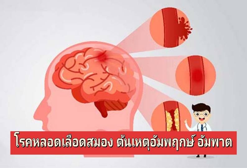 รูปภาพหน้าปก 4ef0ef5d-4563-4149-9cda-5083dc5407e5