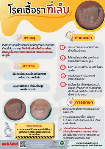 รูปภาพหน้าปก 5d3890d1-c81c-44e9-b183-b925abd7ed3d