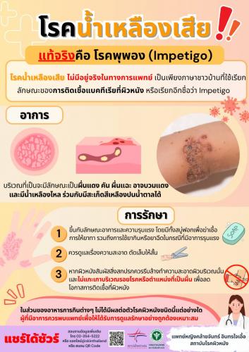 รูปภาพหน้าปก 2eaab926-1d67-44bc-a768-ec4c5fd9376d