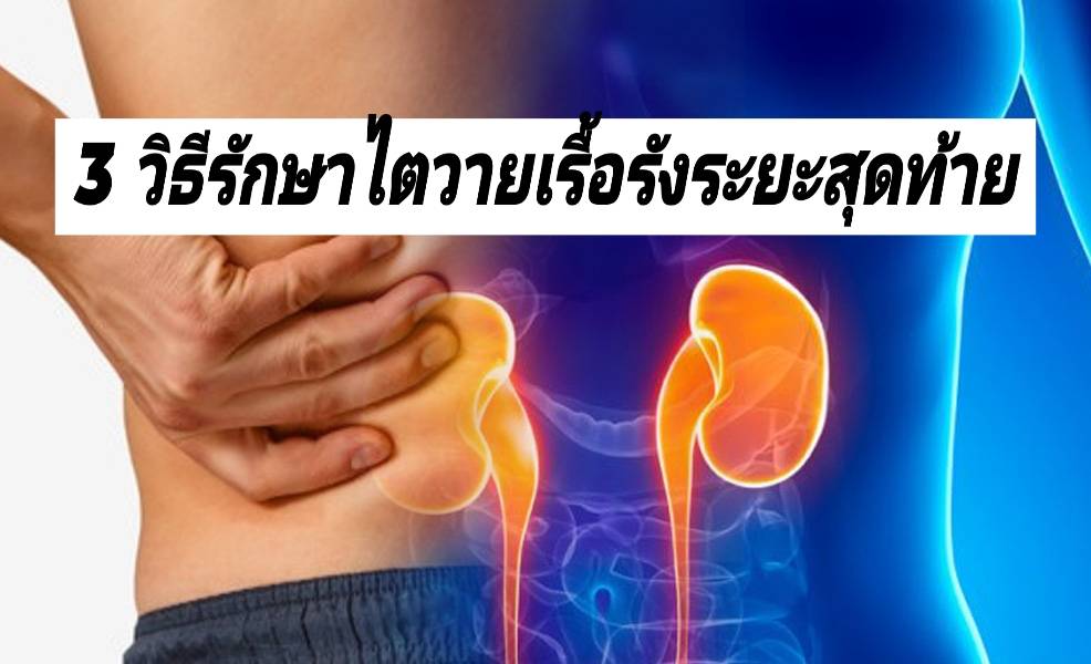 รูปภาพหน้าปก b8f8c385-b943-4c65-a17a-7be6714b8e84