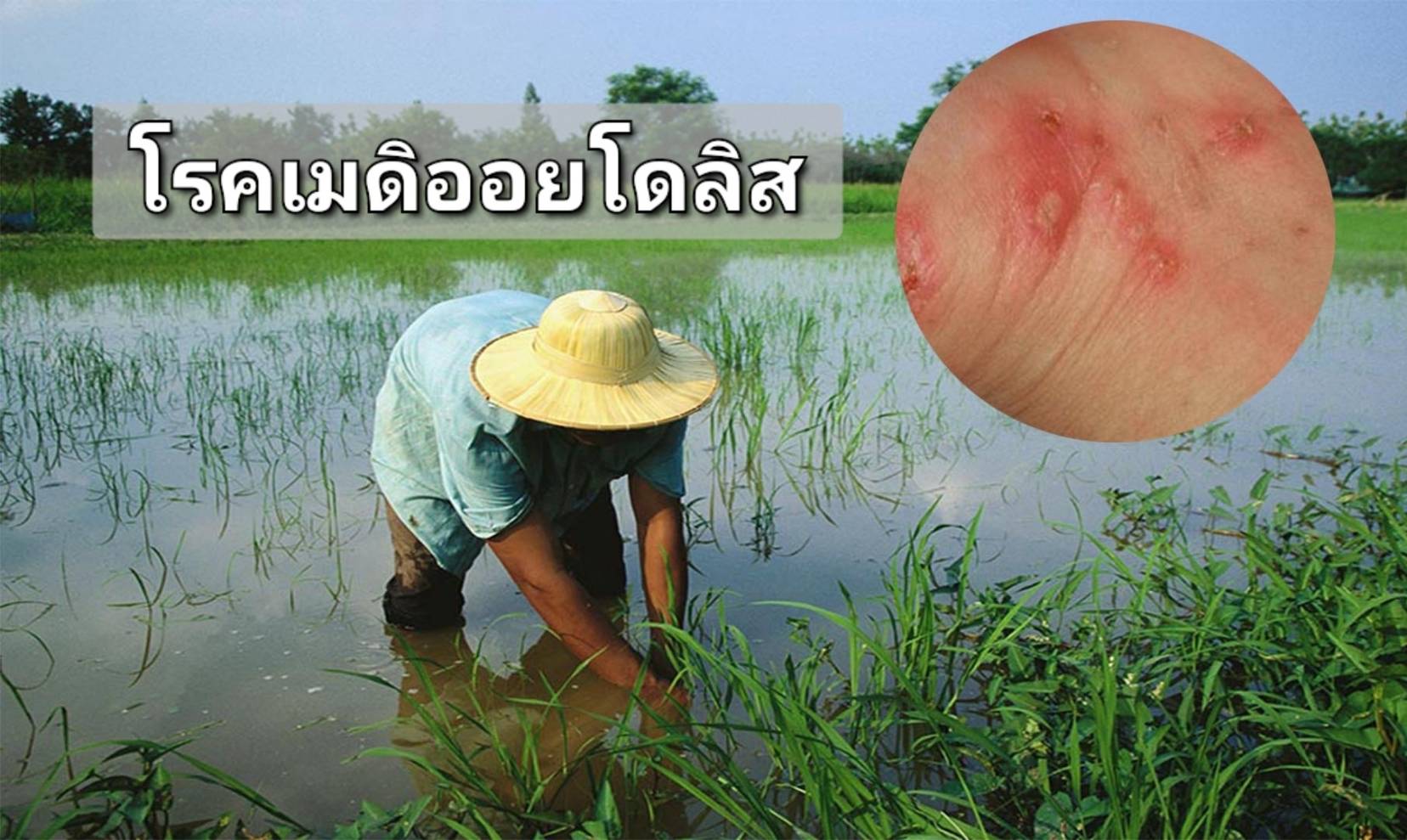 รูปภาพหน้าปก e2cde96e-0074-424b-be14-6edb66a461b8