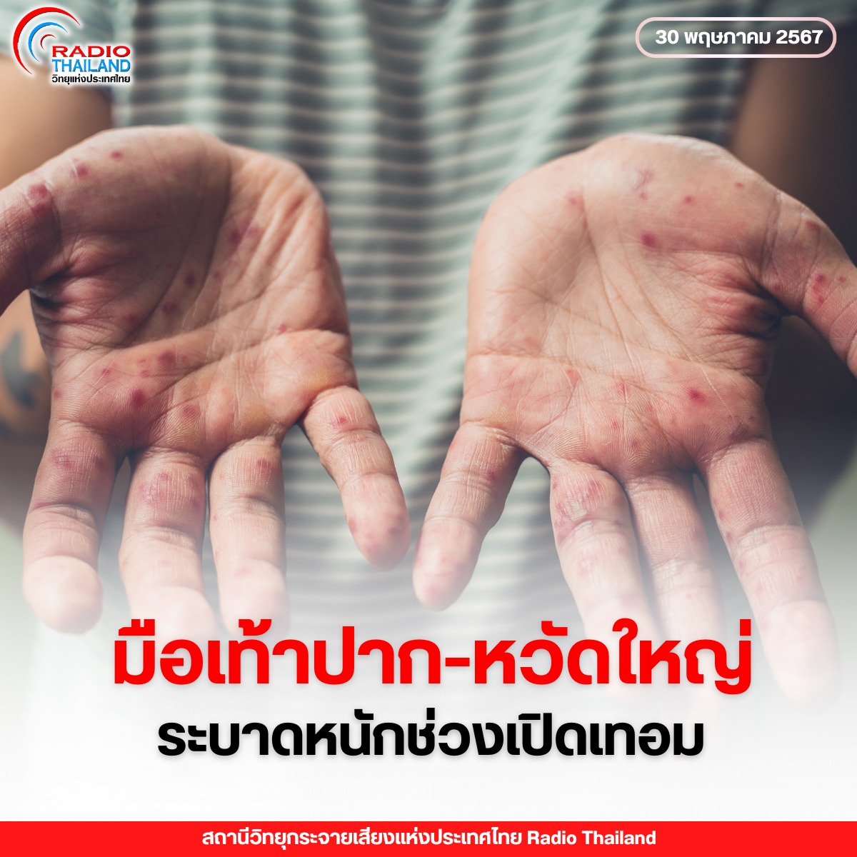 รูปภาพหน้าปก 84058960-c8fe-47ed-96ff-9e6236cc2222