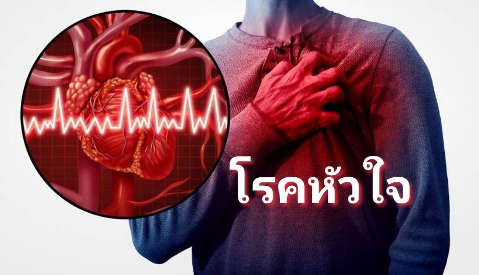 รูปภาพหน้าปก df0efe22-6ae7-440b-9f86-5683c3a6e6d4