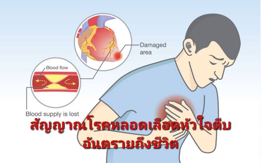 รูปภาพหน้าปก d5c27810-84b5-4f51-b574-d549ea0dbaf5