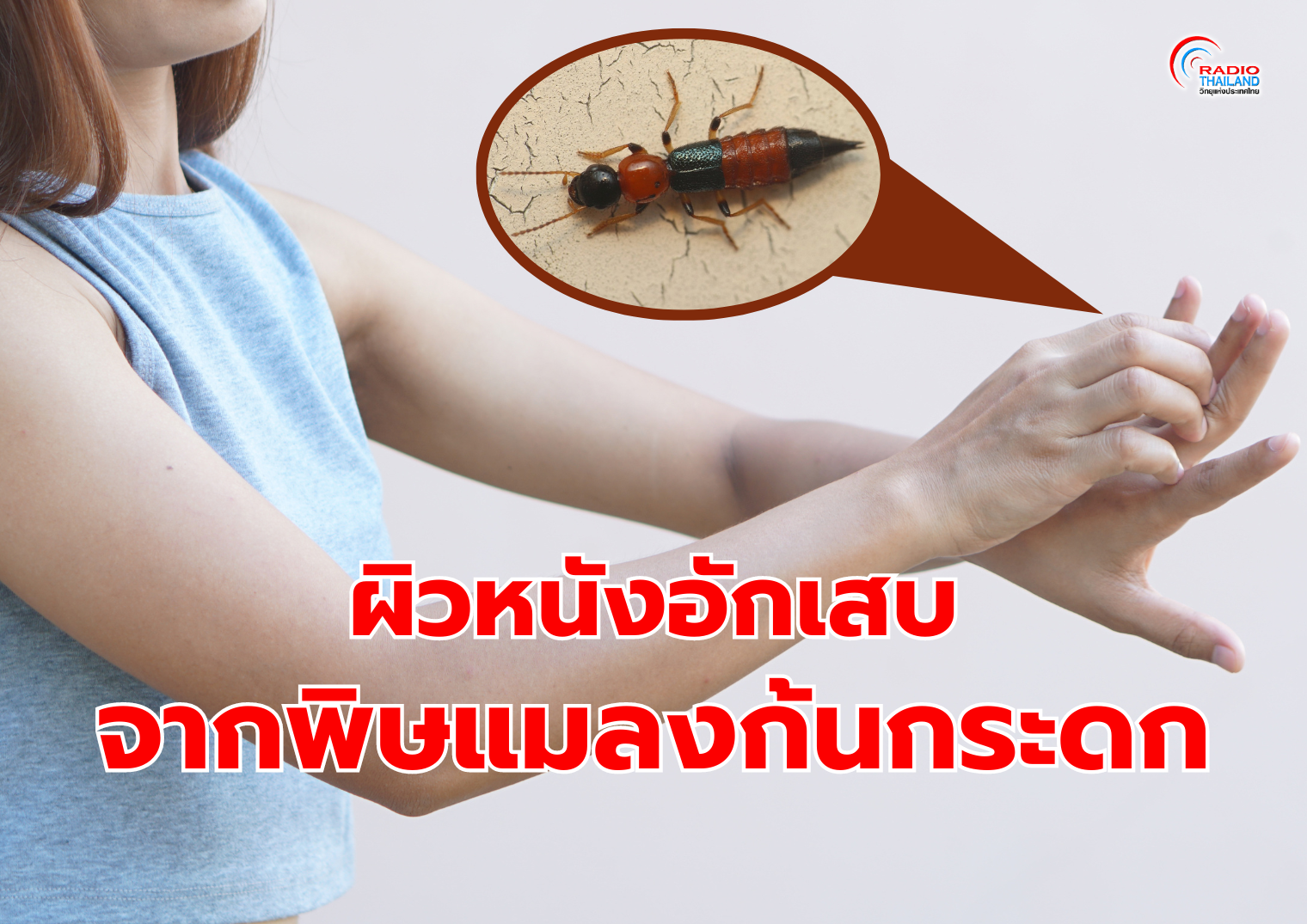 รูปภาพหน้าปก 78c19675-e88b-44b6-9642-c7562a2c4bcf