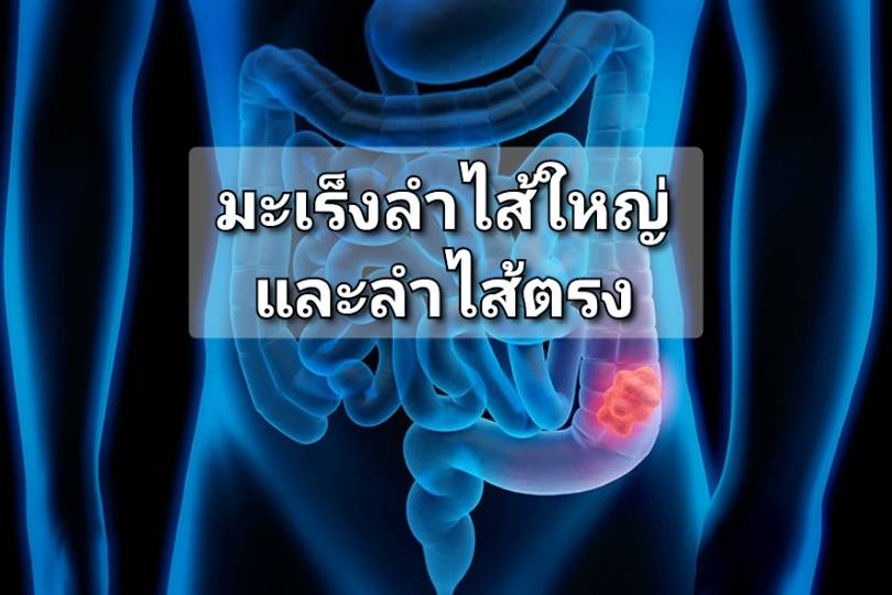 รูปภาพหน้าปก 295c4f7e-b7a9-4e7c-b902-fba7492ee60e